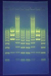 DNA fingerprinting | Definition, Examples, & Facts | Britannica.com