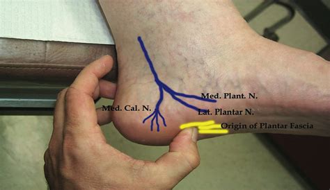 Nerve Pain: Nerve Pain Below Ankle