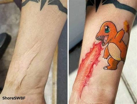 Pokemon fan uses Charmander tattoo to cover up a scar | The GoNintendo Archives | GoNintendo