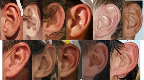 Types of Ears - AnthroScape