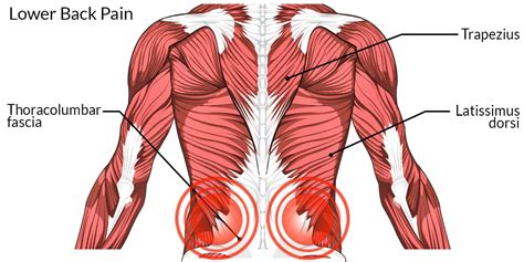 Lower Back Pain - The Complete Injury Guide - Vive Health