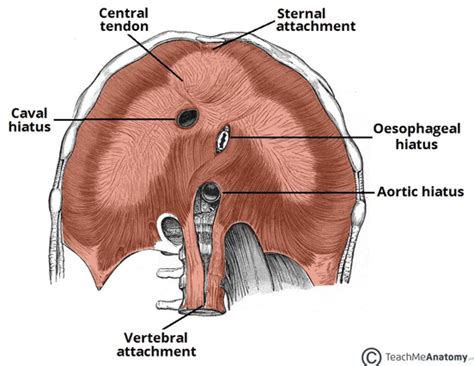 Diaphragmatic Hernia - TeachMeSurgery