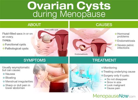 How To Diagnose Ovarian Cysts - Ademploy19