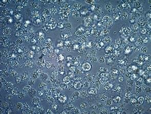 Cell Culture Contamination Troubleshooting