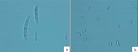 Appearance under the microscope of Fusarium redolens, a. Macroconidia... | Download Scientific ...