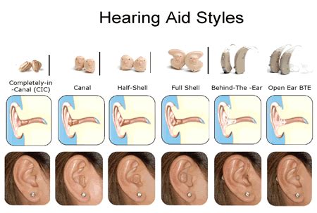 What is the difference between the available types of hearing aids? - Isaac Namdar, MD