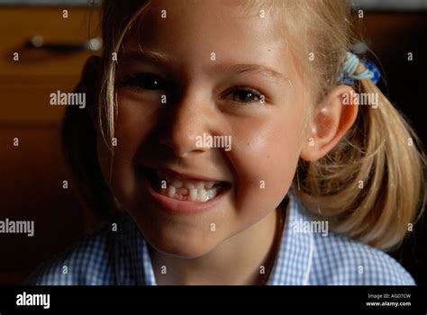 Portrait of a little girl with her front teeth missing Stock Photo - Alamy