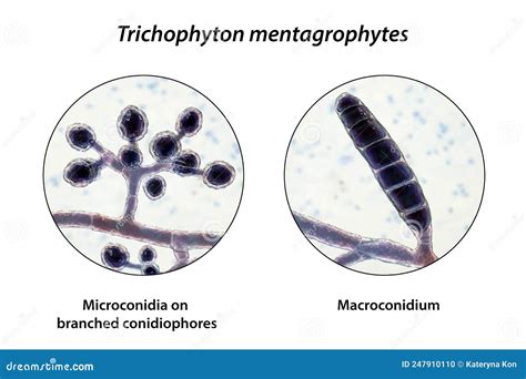 Fungi Trichophyton Mentagrophytes, 3D Illustration | CartoonDealer.com #247910110