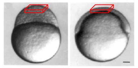 2: Zebrafish embryo. Scale bar: 100 µm. The boxes represent the region... | Download Scientific ...