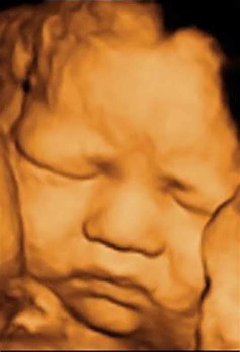 3D Ultrasounds In Reno | Women's Health Center of Reno, NV