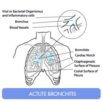 Coughing Up Phlegm (Sputum, Mucus) – Clear, Green, Yellow and with Blood