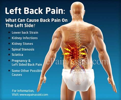 lower back pain left side