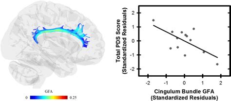 Cingulum bundle and post-traumatic stress. A negative relationship was... | Download Scientific ...