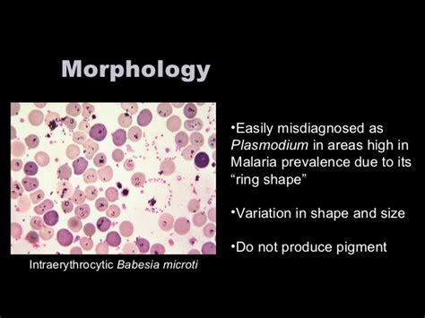 Babesia microti