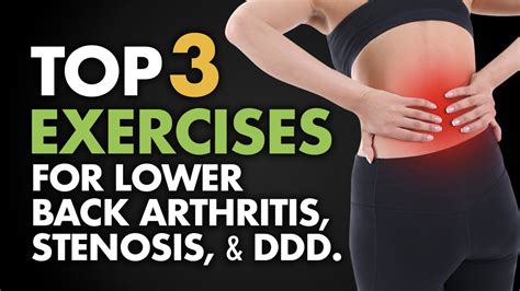 Where is lower back arthritis pain felt? - Health Blog