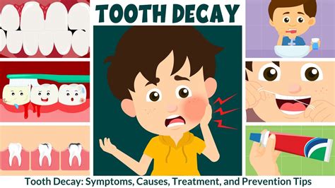 Cavities (Tooth Decay): Symptoms, Causes & Treatment - weheartanimals.info