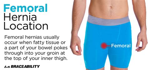 Inguinal Hernia Belt | Scrotal & Femoral Groin Support Truss