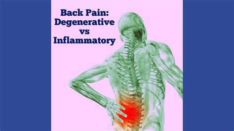 Back Pain- Inflammatory versus Degenerative - Chicago Arthritis and Regenerative Medicine