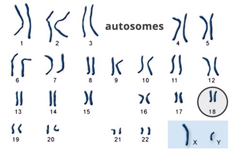 Parents & Families | Trisomy 18 Foundation