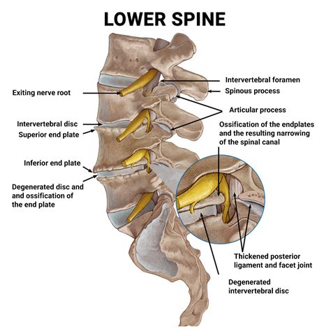 Sharp Stabbing Pain in Lower Left Side of Back - Physical Therapists NYC