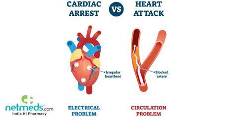 Cardiac Arrest