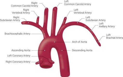 Pin by Joey Nicholas on Cath lab | Carotid artery, Arteries, Vertebral artery