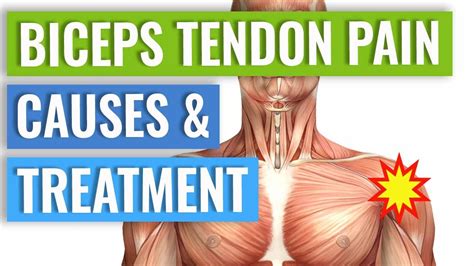 Biceps Tendonitis Treatment and Exercises Explained - YouTube