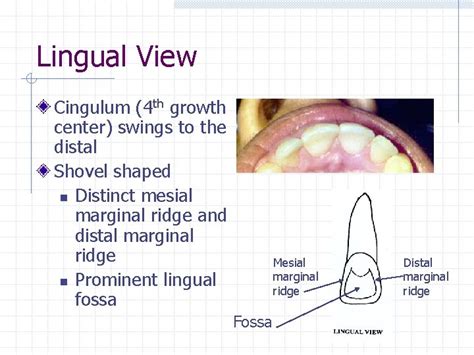 Permanent Anterior Teeth Incisors Chapter 16 Central Incisor