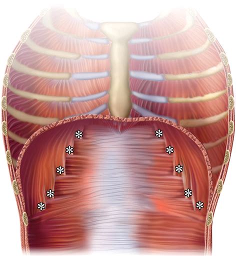 Diaphragm Muscle Cadaver