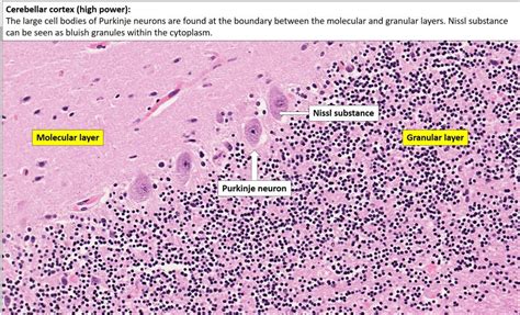 Brain – Cerebellum – NUS Pathweb :: NUS Pathweb