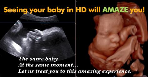 3d Ultrasound - Hd Ultrasound in Austin, Texas - Clearview Ultrasound