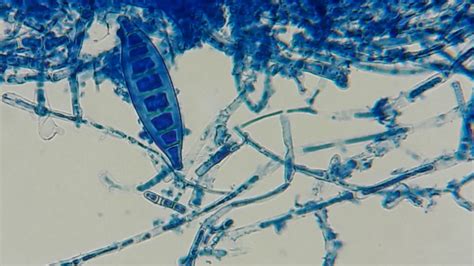 31 Macroconidia Microsporum canis - YouTube