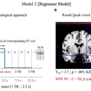 Neuroimaging data analysis and results. (A) Graphical illustration of... | Download Scientific ...