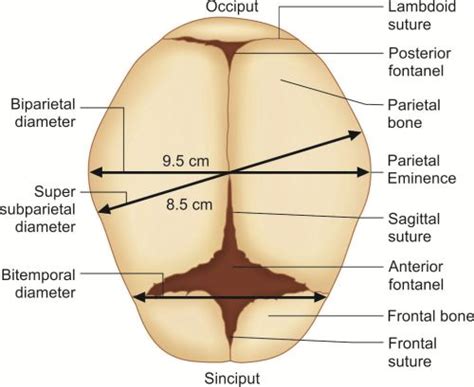 Sutures Of The Fetal Skull