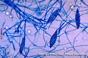 Microsporum canis - Doctor Fungus