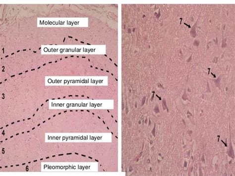 Cerebrum Histology Labeled