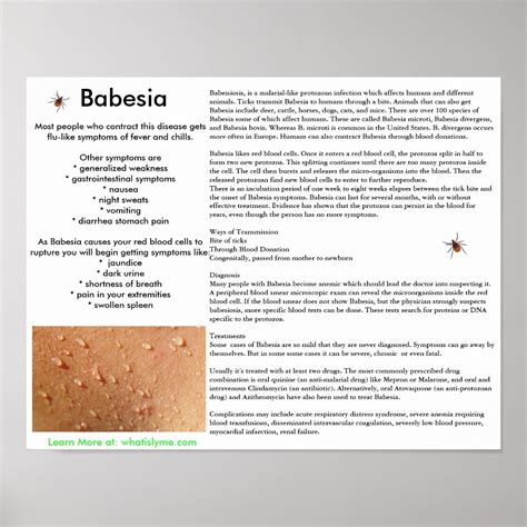 Babesia Symptoms and Transmission Poster | Zazzle