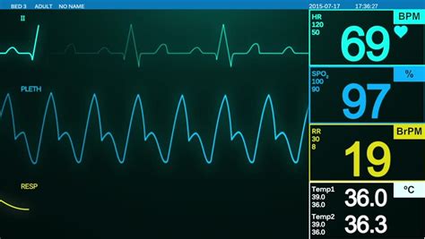 Heart Rate Monitor Stock Footage Video - Shutterstock