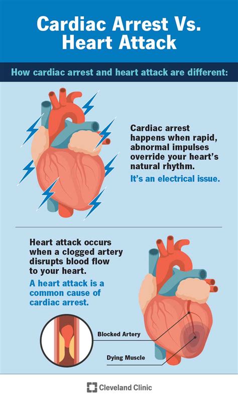 Sudden Cardiac Arrest: Causes & Symptoms