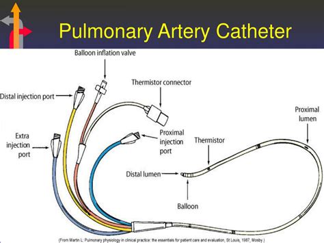 Pulmonary Arterial Catheter