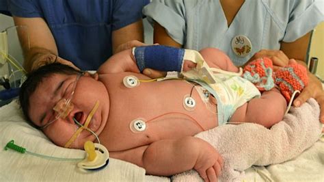 13-Pound Baby Jasleen Born Naturally, but World Record Stands - ABC News