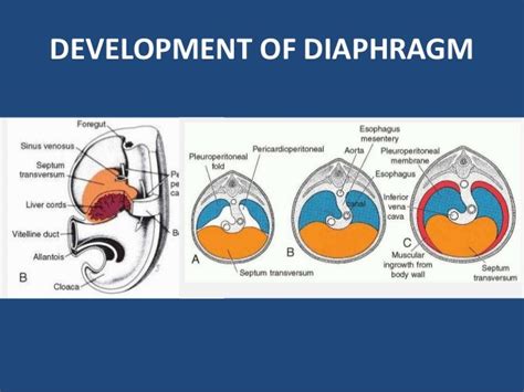 Diaphragmatic hernia