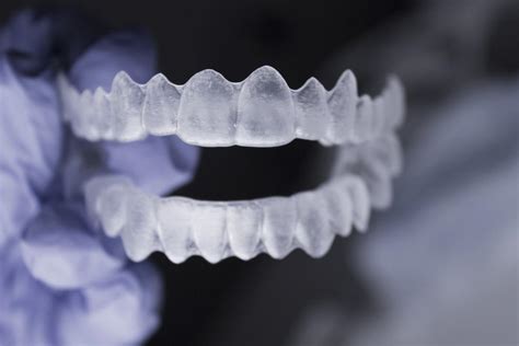 Best Invisible Braces | The Miami Cosmetic Dentists