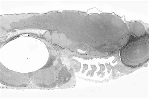 Scientists create 281-gigapixel embryo image comprised of more than 26,000 photos - The Verge