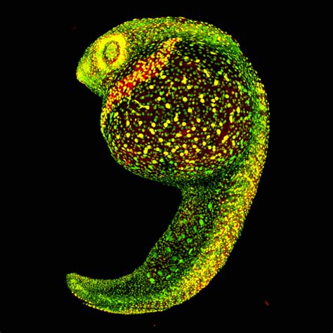 Zebrafish embryo, 22 hours post-fertilization, living specimen | Nikon’s Small World