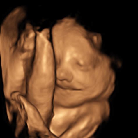 29 Weeks 3D - Firstview Ultrasound