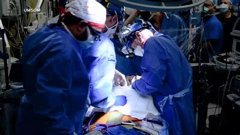 In 1st, US surgeons transplant pig heart into human patient - ABC7 Los Angeles