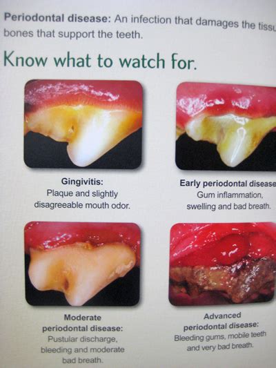 Periodontal Disease Stages In Dogs