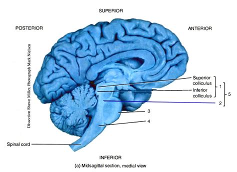 SOLVED: Label the brain stem structures in the figure below Word Bank corpora quadrigemina ...