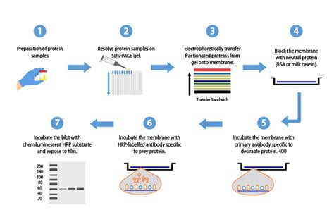 All you need to know about the Western Blots and their importance in protein detection | HHC